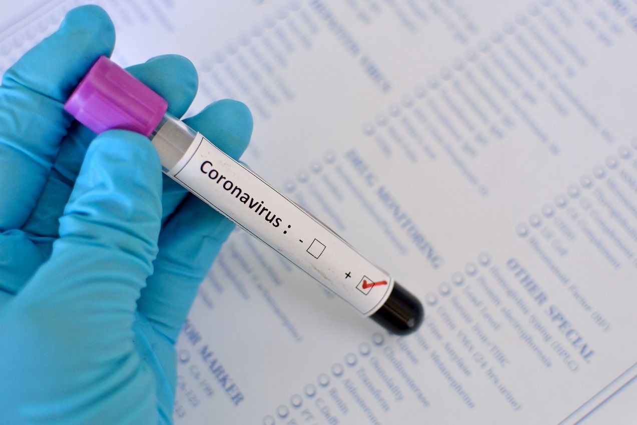 coronavirus-foi-classificado-pela-oms-como-pandemia-