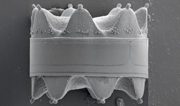 Rainha da Amazônia: amostra de água vista com microscópio tem a forma de uma coroa