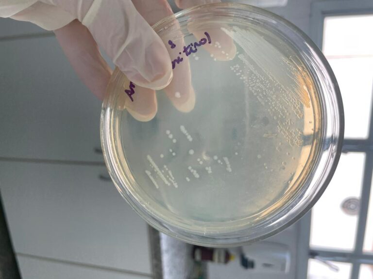 Pesquisadores desenvolvem novo detector de anticorpos contra vírus da encefalite de Saint Louis na Amazônia