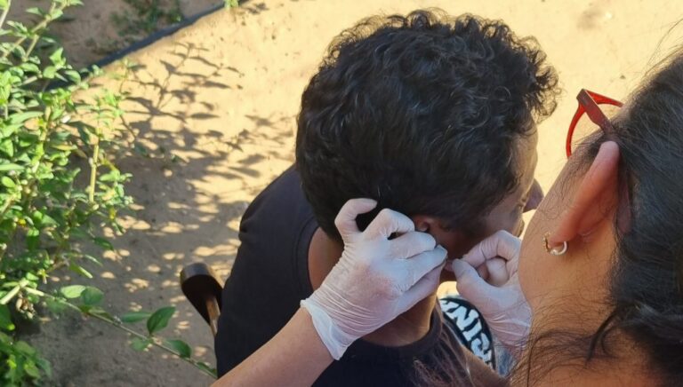 Hanseníase: descoberta do Mycobacterium lepromatosis revisa história da doença nas Américas