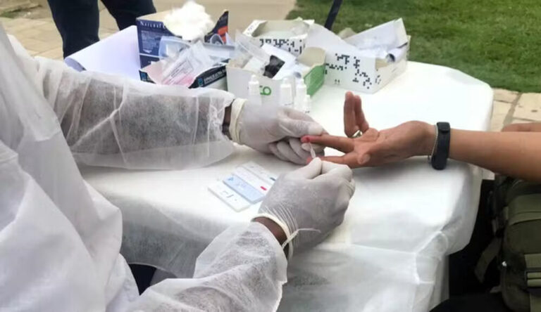 Estudo de iniciação científica analisa mortalidade por Aids no Amazonas