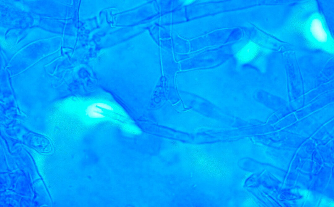 O fungo C. theobromae sob o microscópio. Imagem: Juan M. Pardo / CIAT - vassoura de bruxa na mandioca
