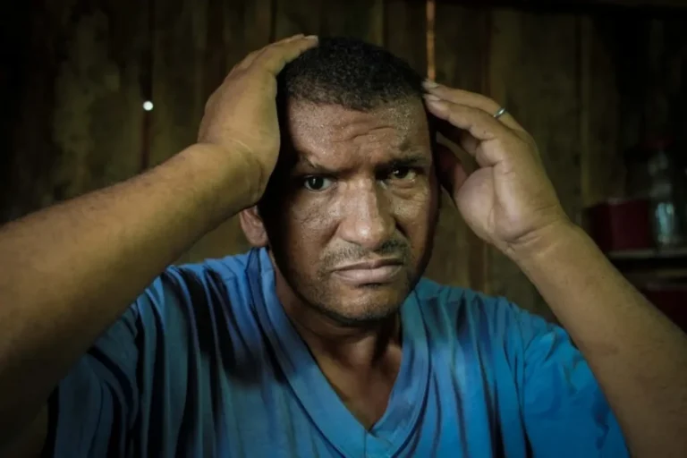 Sobrevivente do Massacre de Eldorado do Carajás tem bala no olho há 30 anos